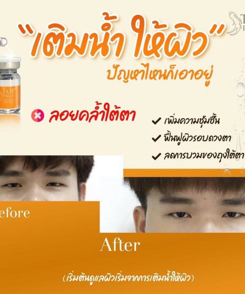 LINE_ALBUM_ใต้ตาคล้ำ_220815_0